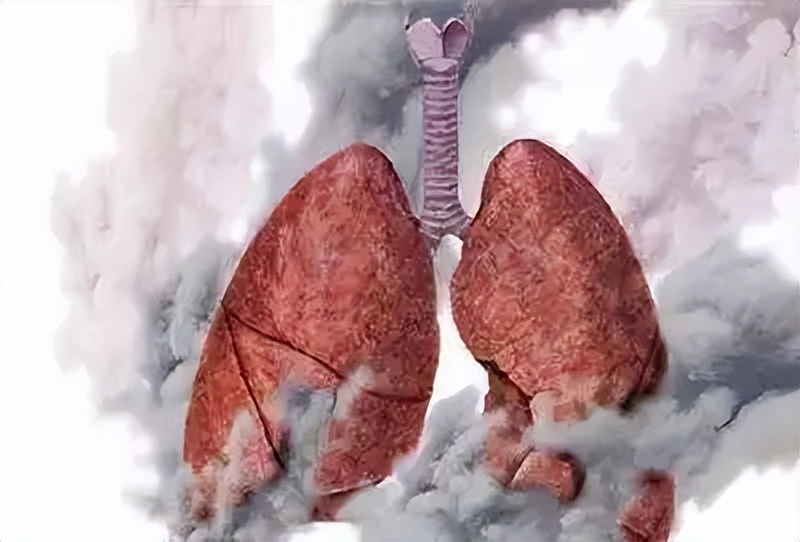 中医名方治疗慢阻肺,名老中医治慢阻肺的验方