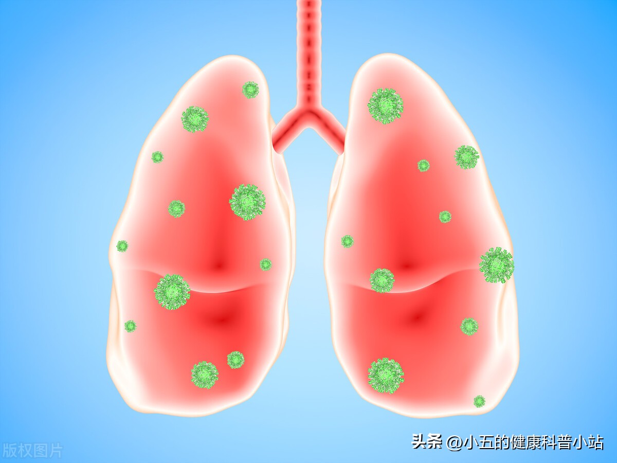 盐酸氨溴索口服溶液治疗肺炎,支气管肺炎用盐酸氨溴索效果好吗