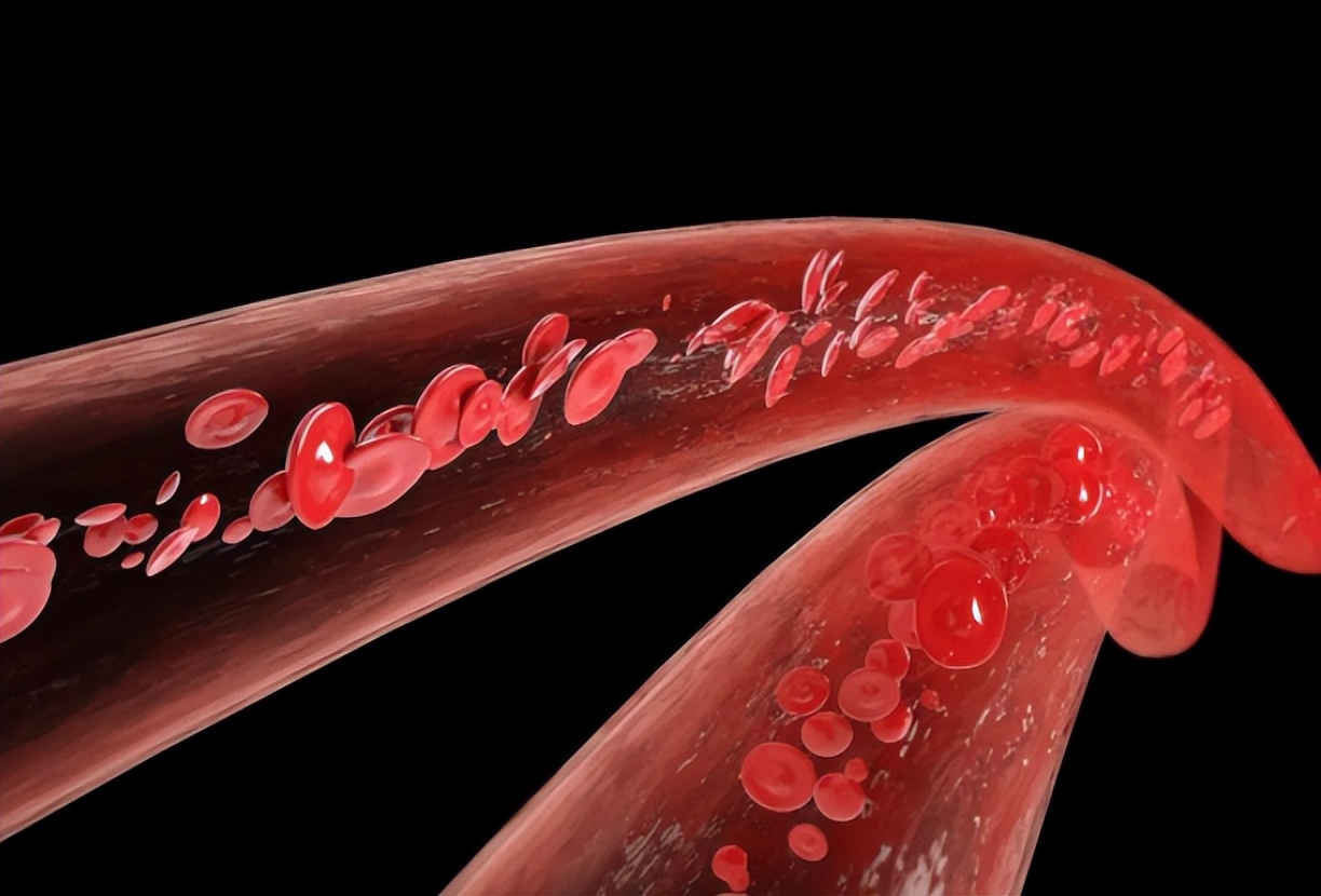花5万输年轻人血液,就能“返老还童”?揭开美国换血疗法真面目