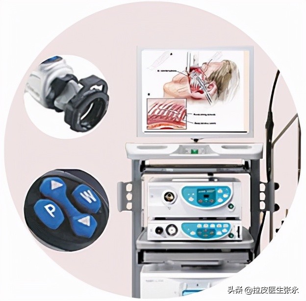 除皱拉皮手术亲身经历,50岁以上的如何做拉皮手术