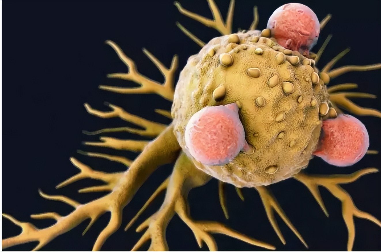 放疗“敌我不分”，想减少损伤身体，要做好这几点