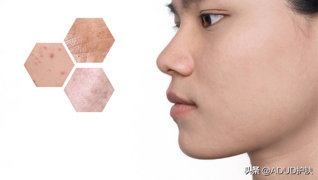 痘痘硬硬的无脓头该怎样消除,痘痘变成硬硬的鼓包挤出血