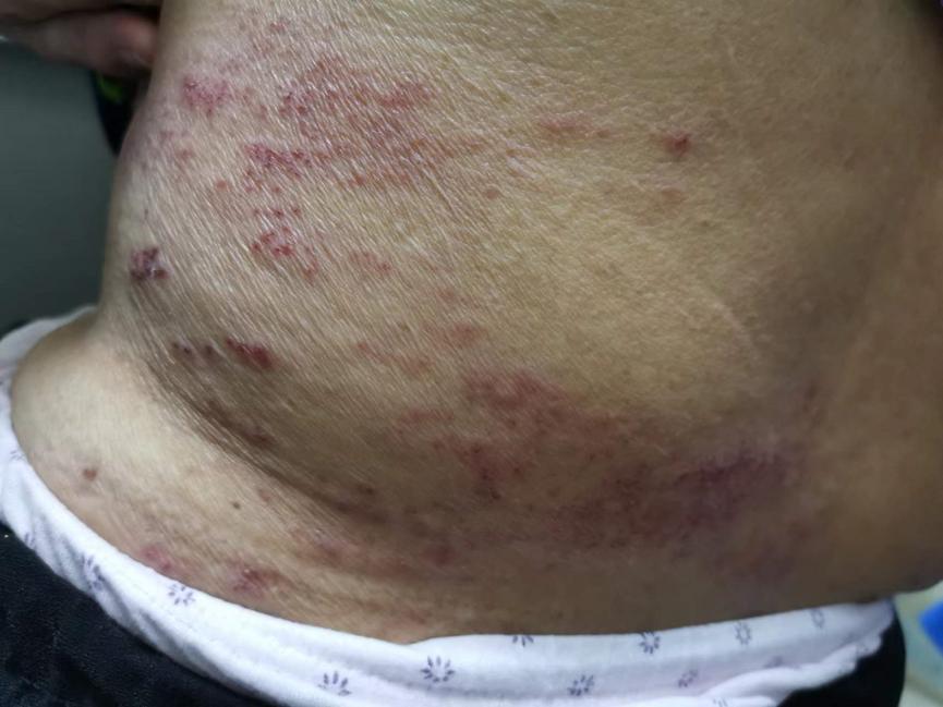 鍏ㄧ鍖荤敓甯︿綘娌荤枟甯︾姸鐤辩柟,甯︾姸鐤辩柟鍩硅瀛︿範