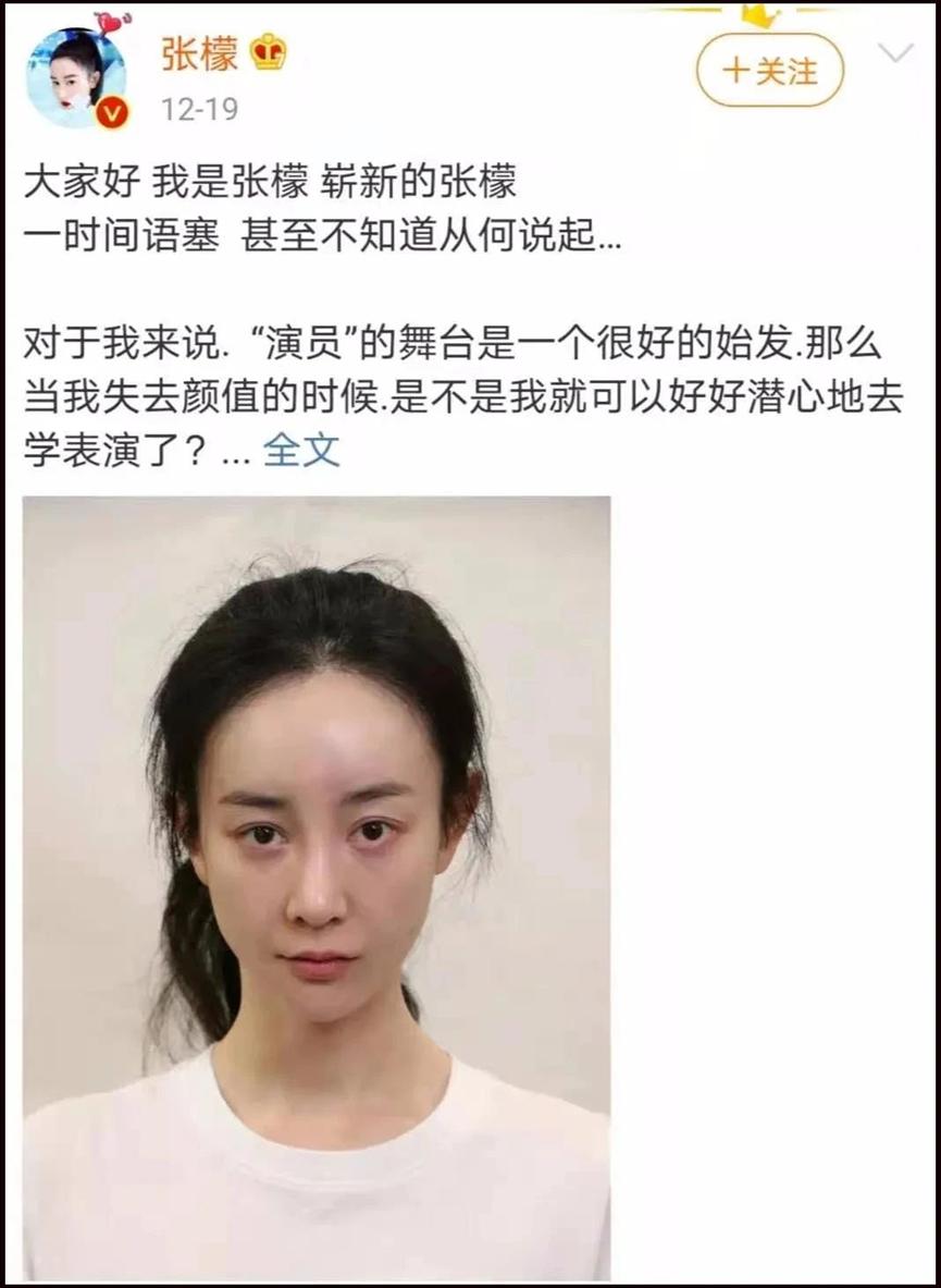 明星也逃不开的容貌焦虑：女星卸妆前后对比，自信的人才最美丽