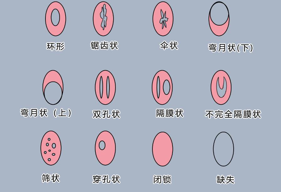 处女座的大揭秘,揭秘最真实的处女座