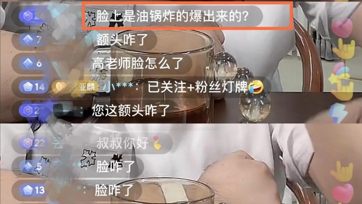 高亚麟是不是得了什么怪病,高亚麟扁平疣怎么祛除的