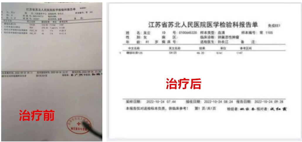 陈海林治疗癌症,陈海林肿瘤名医