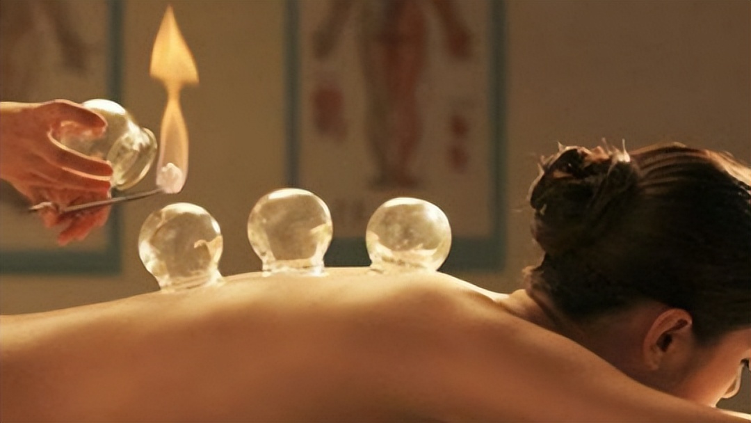 拔火罐益处和弊端,拔火罐有什么好处跟坏处呀