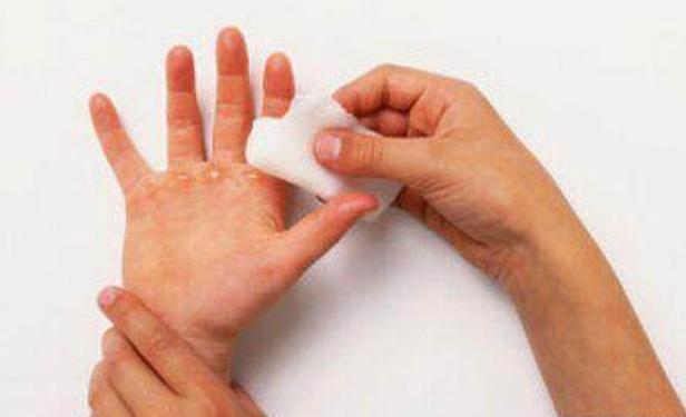 小孩被开水烫伤怎么办最快最有效,小孩被开水烫伤怎么处理最好恢复