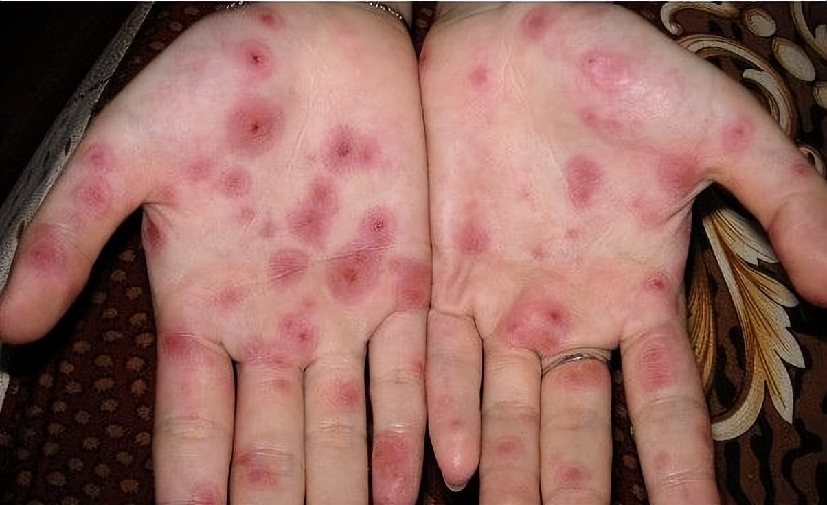 除了艾滋病还有什么可怕的病,除了艾滋病还有什么病治不好