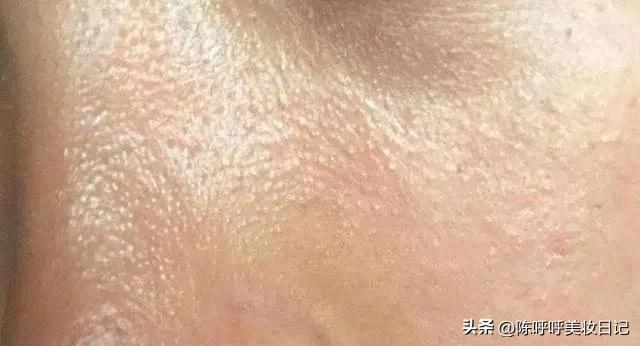 2020夏季爽肤水推荐,爽肤水夏季推荐