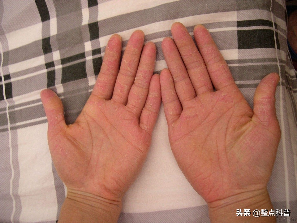 洗洁精是害人精这种说法对吗,洗洁精对人体的危害谣言