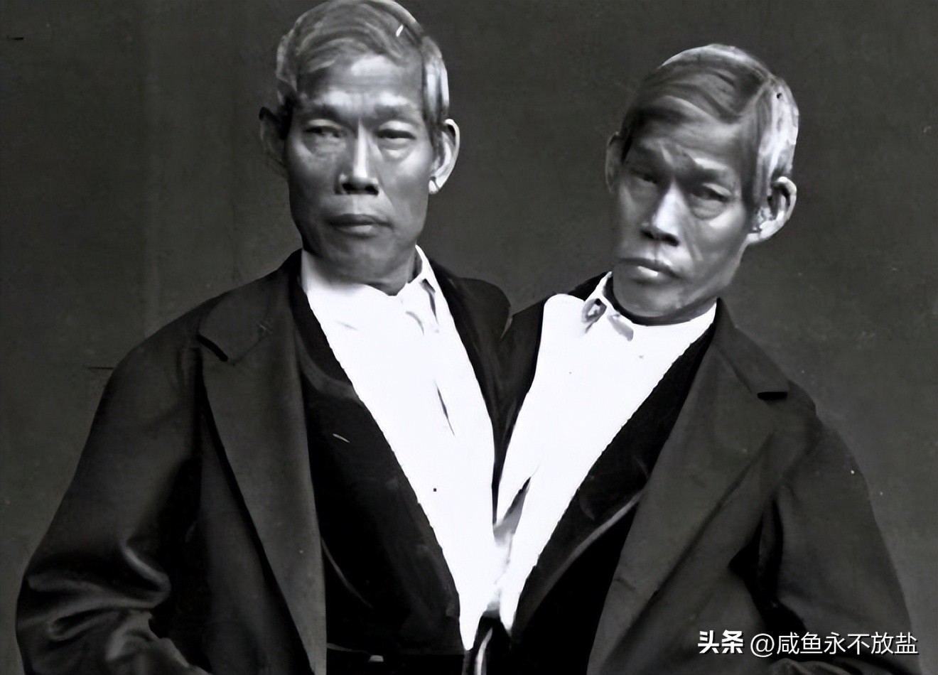 女子生下连体双胞胎后续,女子产下同母异父双胞胎完整版