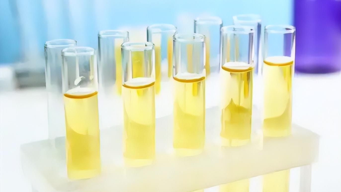 尿蛋白越高治疗好后复发几率越高,肾病尿蛋白高怎么办怎么能降下去