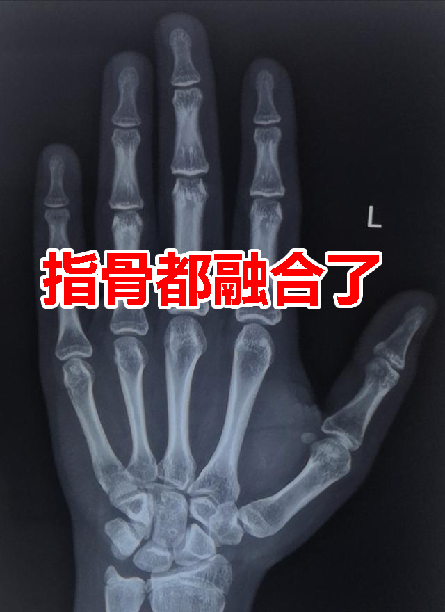 孩子不长个什么时候开始干预,孩子什么时候开始管教最好