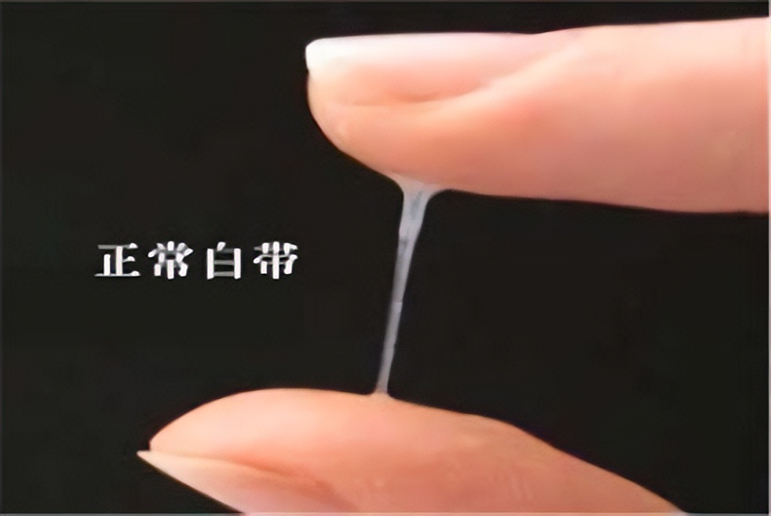 女裤黄黄的是什么原因,裤底发黄怎么回事