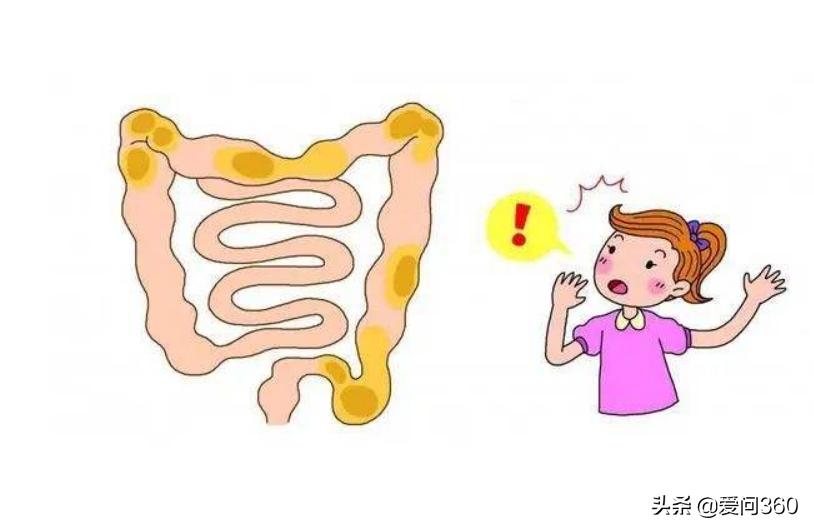 大肠息肉是什么原因引起的啊,大肠息肉什么原因引起的