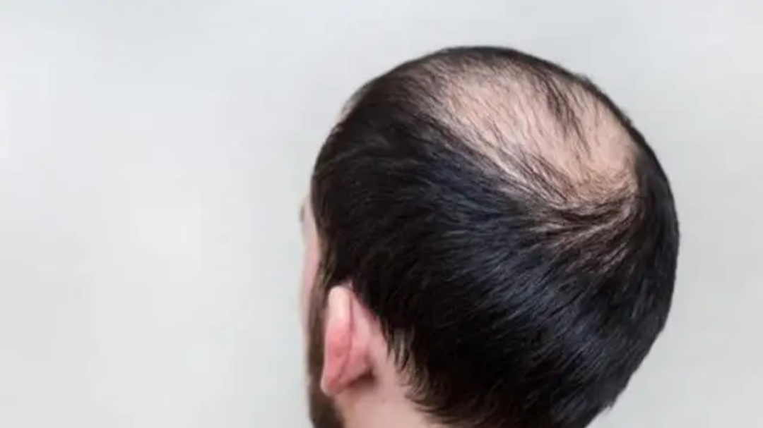 五十岁男人雄激素减少怎么办,男60岁后雄激素依然旺盛好吗