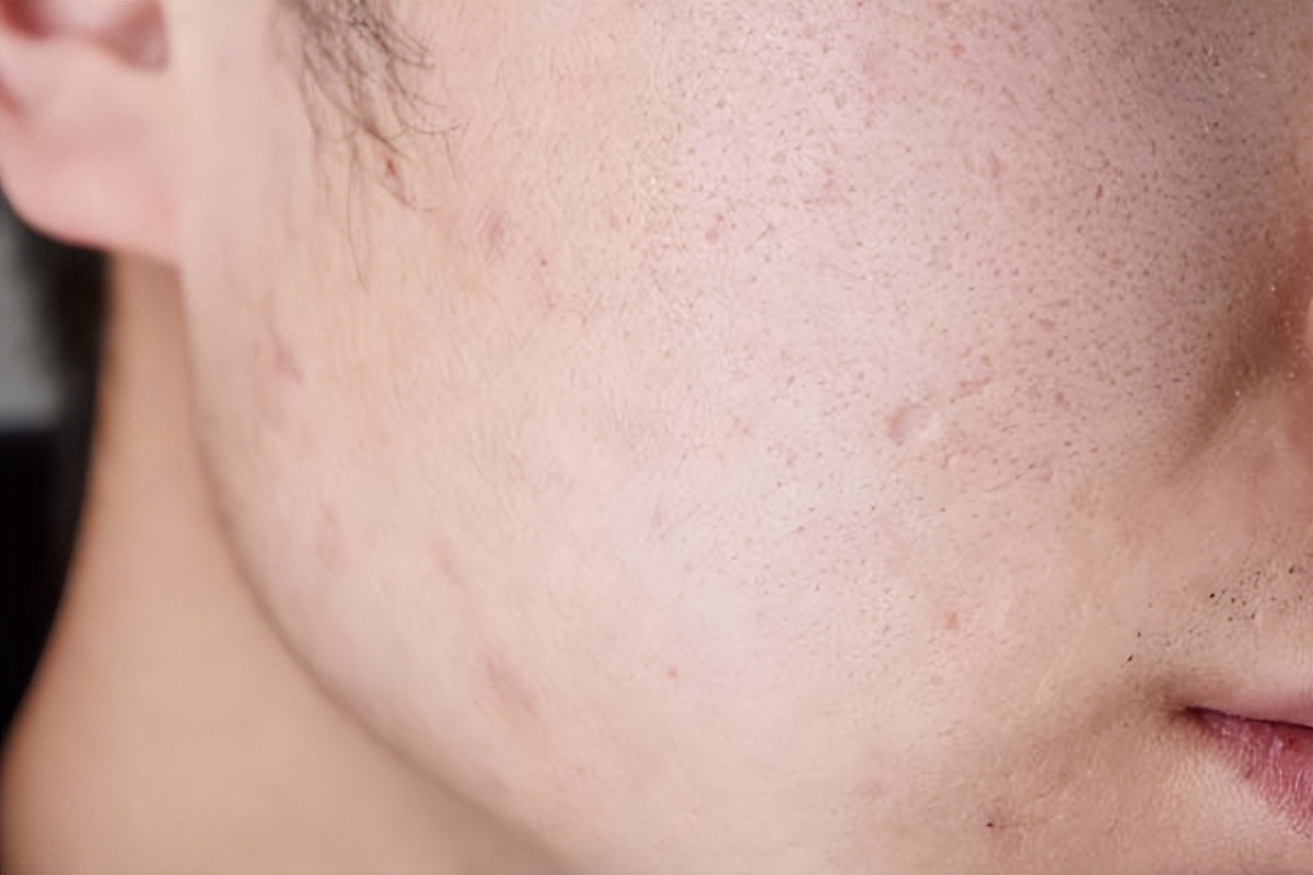 颈部多发小淋巴结是肿瘤吗,腋下长了个鸡蛋大小的瘤是什么