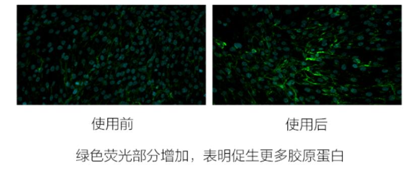 修复敏感肌抗衰老,扎心用什么方法可以缓解