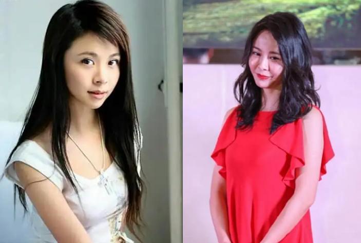 最近脸僵硬的女星,脸部变僵硬的女明星