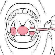 口咽、鼻咽拭子采集标准