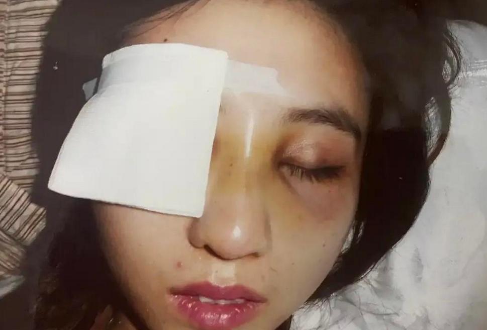 15年非洲富二代追求东北独眼美女,隔年领证裸婚,如今2个混血娃