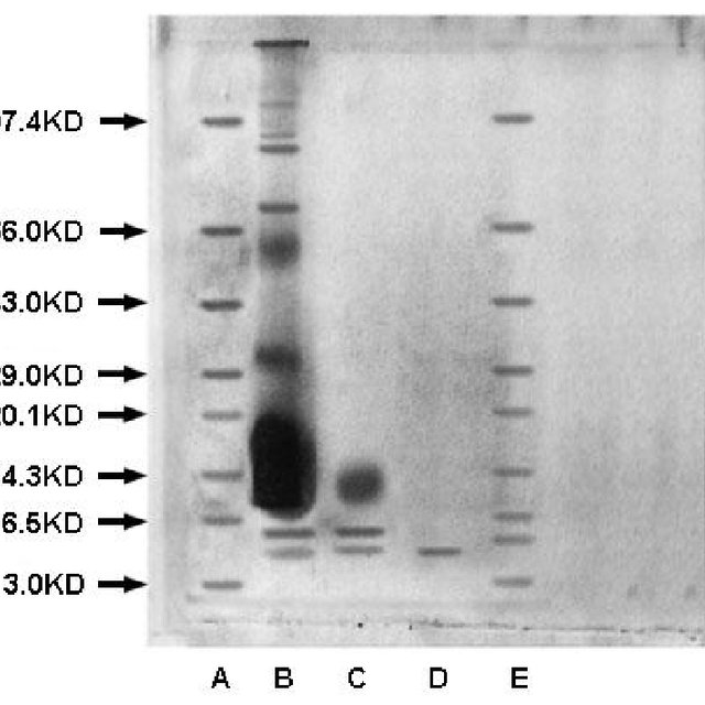 葡聚糖凝胶g15适用范围,葡聚糖G25凝胶