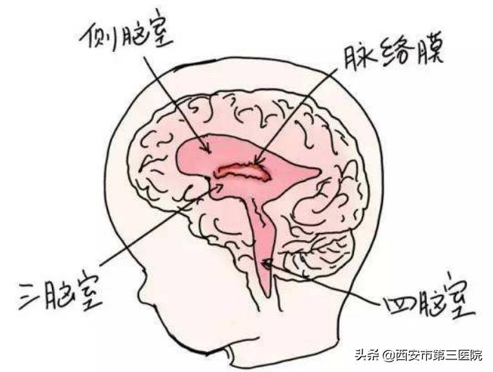 脉络丛囊肿超声表现,超声显示胎儿囊肿怎么办