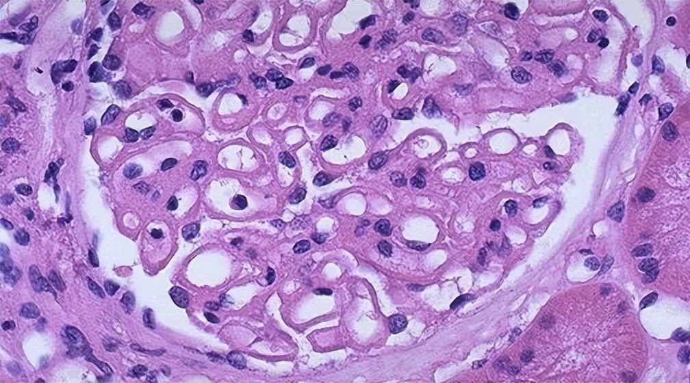 小儿急性肾小球肾炎致病菌,引起急性肾小球肾炎的病原体是