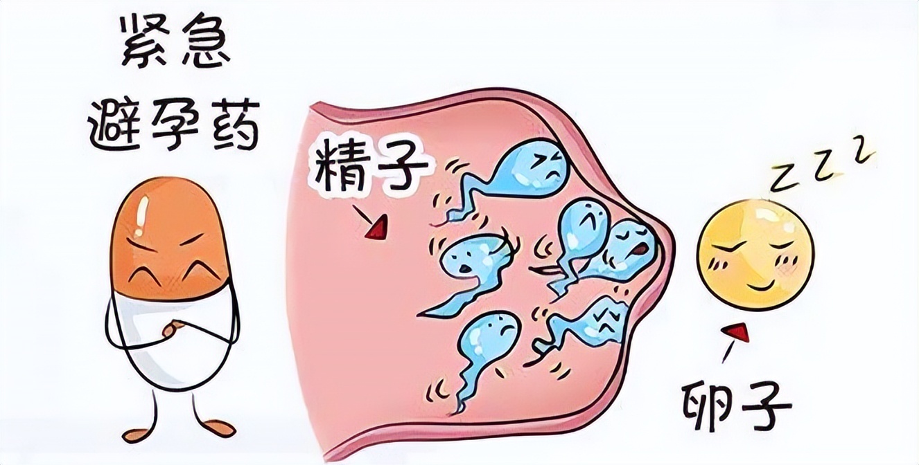 服用紧急避孕药后容易怀双胞胎吗,吃紧急避孕药还是会怀孕吗