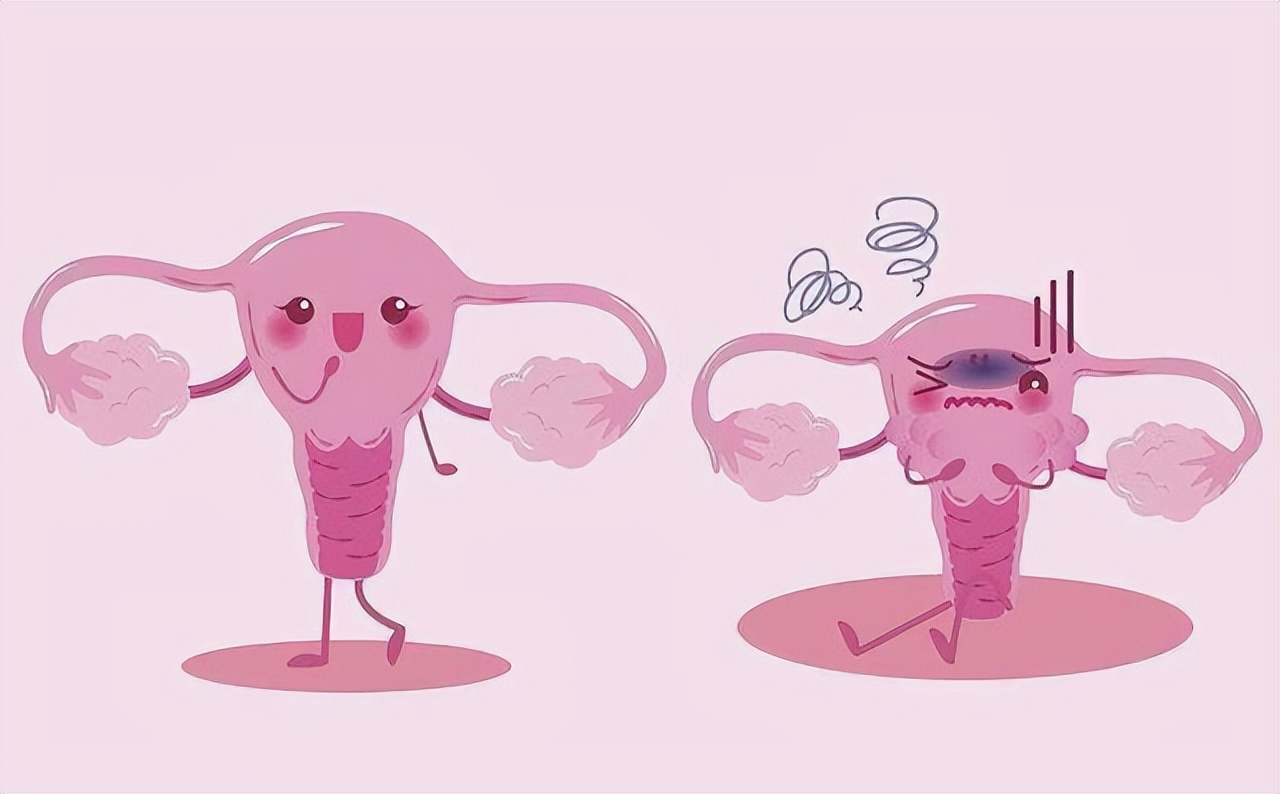 为何日本女性得妇科病的比较少,为什么日本女性很少患妇科病