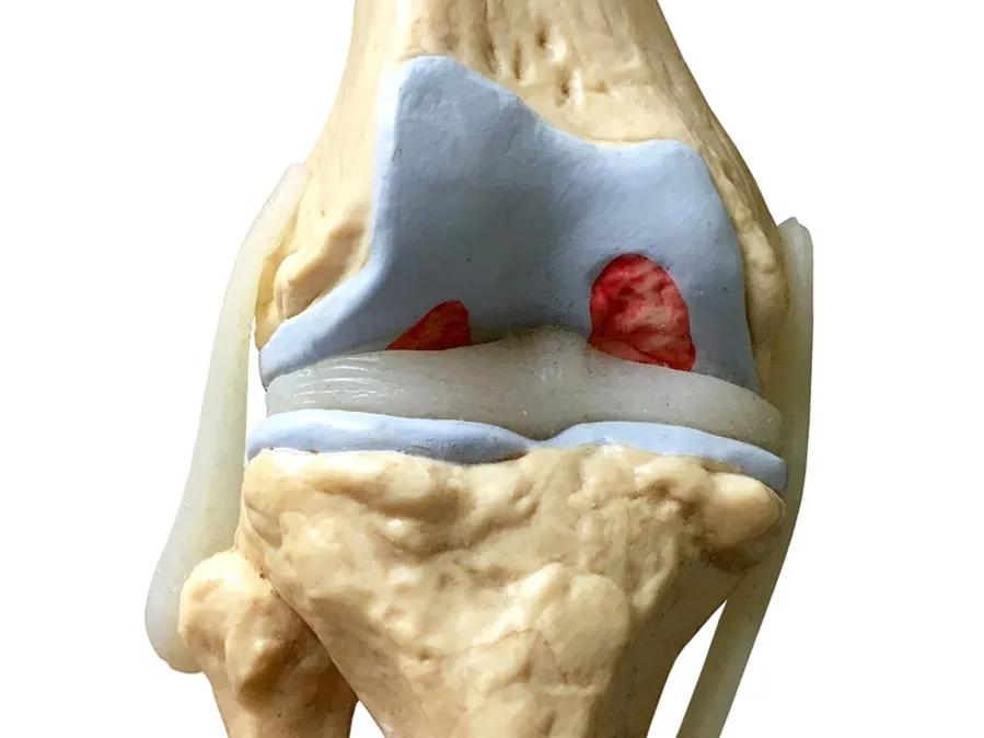 氨糖软骨素到底有没有用,氨糖用多了