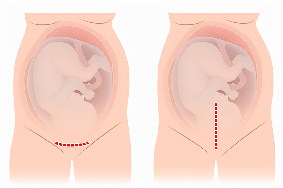 小伙体验生孩子疼痛30级,男人被女友逼生孩子