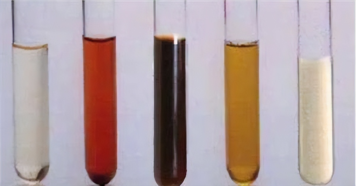 尿标本为何是晨尿,什么时段的尿液标本检查更准确