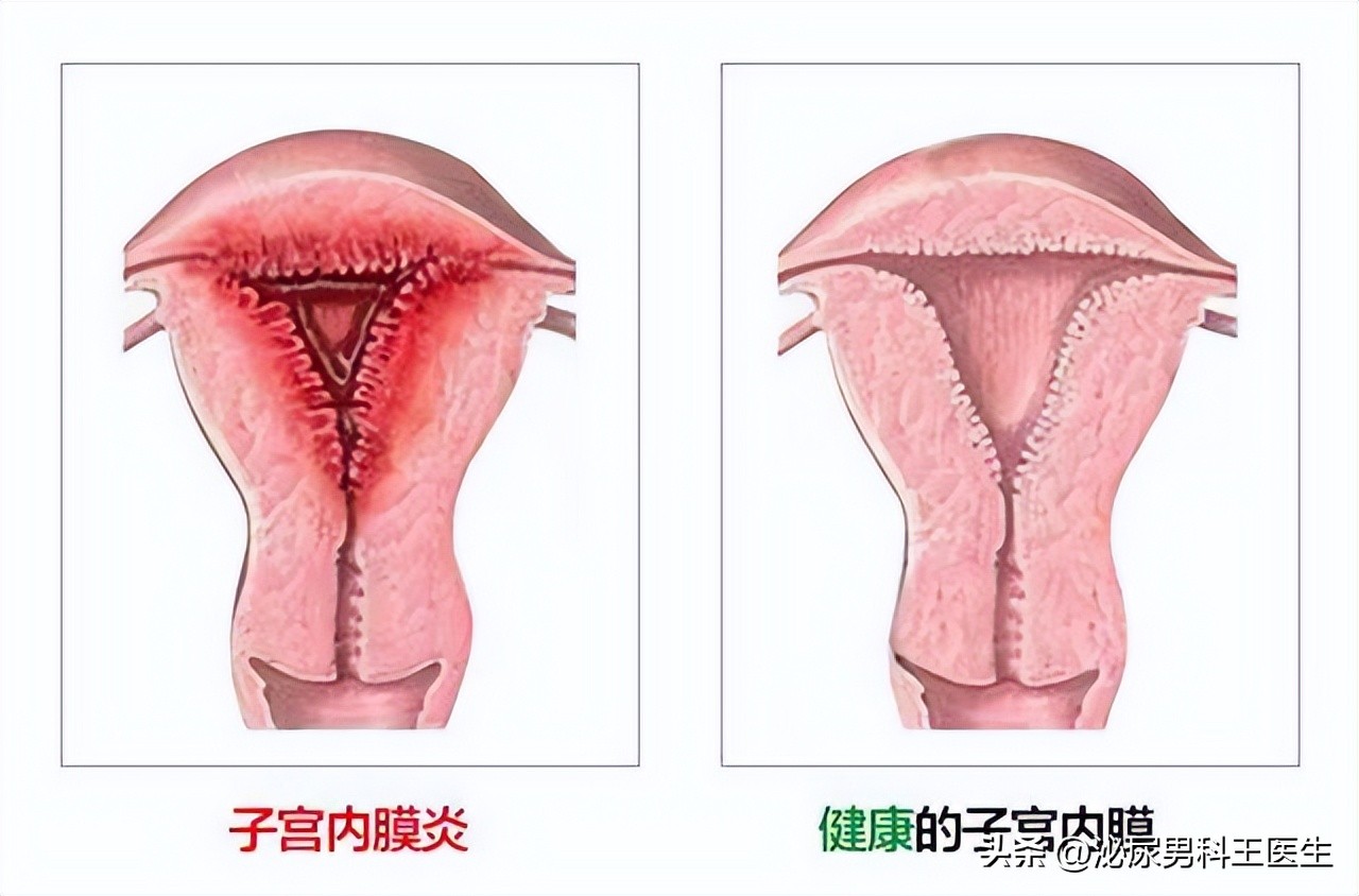 节育环多大年龄取出好取,节育环一直不摘