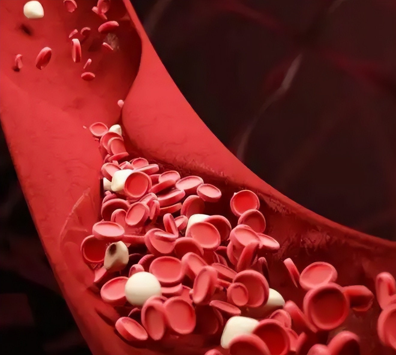 二级高血压日常生活注意什么,高血压的等级是如何划分的