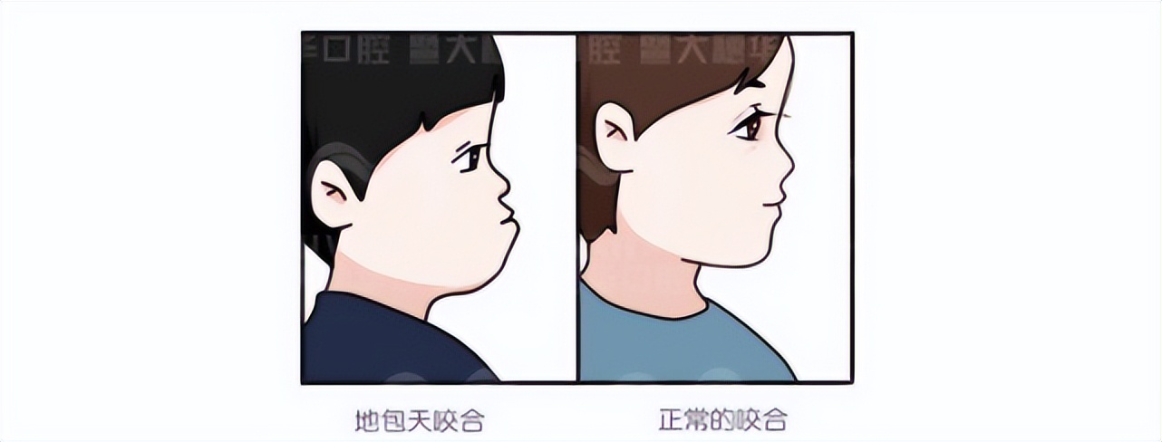 牙齿畸形的矫正是怎么个方法,8种牙齿畸形必须矫正一图读懂