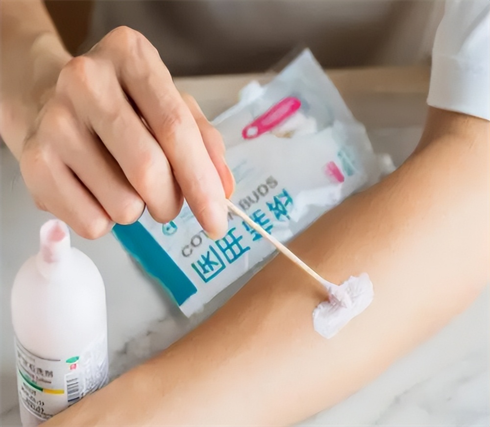 几块钱一瓶的炉甘石洗剂,炉甘石抑菌洗剂多少钱一瓶啊