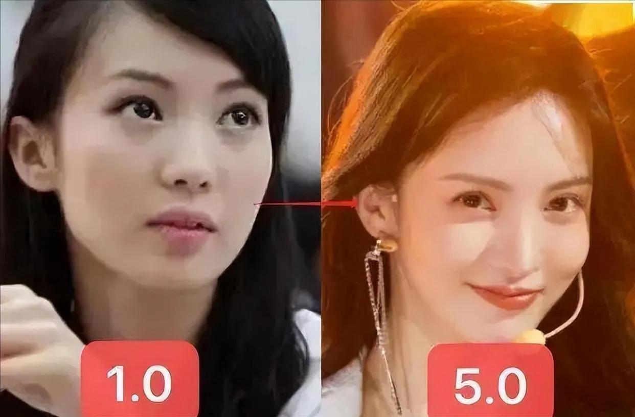 娱乐圈天然脸vs整容脸,娱乐圈没有整容的人纯天然的脸