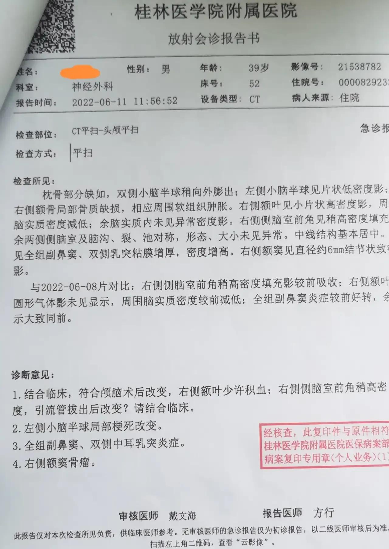 大面积脑梗中风康复案例,脑梗康复的真实经历