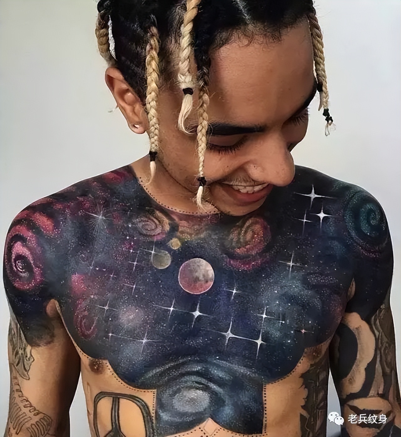 纹身增生疤痕怎么去除,纹身为什么会有增生