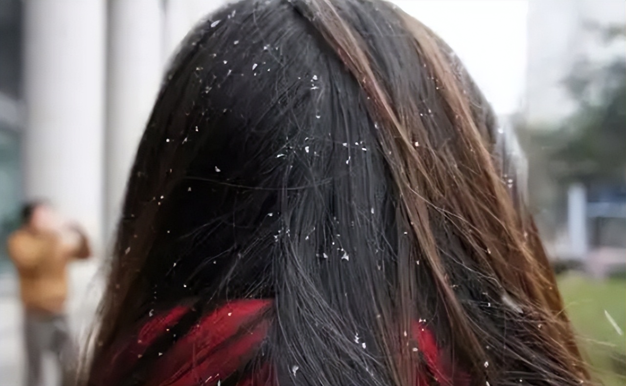 头皮上长红疙瘩和黄色脓包,头皮经常起小脓包疙瘩很疼