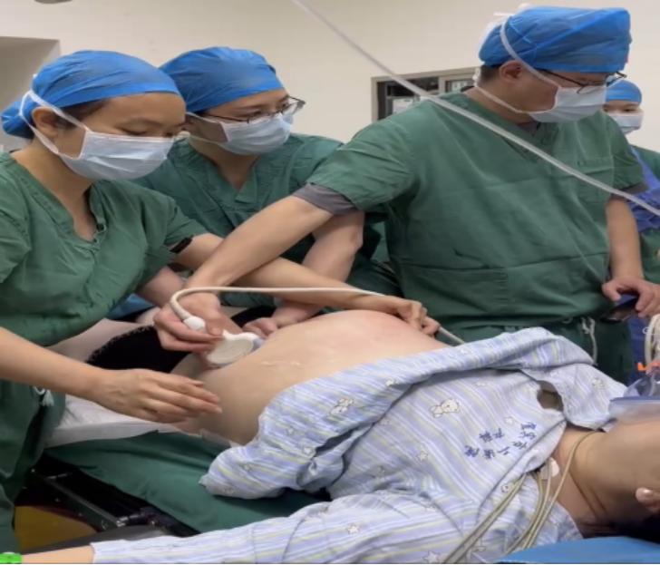 宜宾首例!“臀位”变“头位”,华西宜宾医院成功开展徒手臀位外倒转术