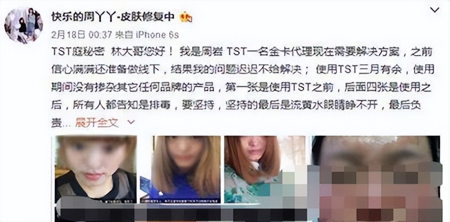 张庭赚钱模式,张庭疯狂囤货背后