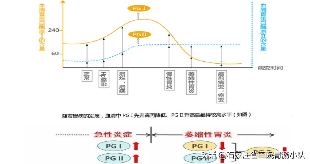 胃功能三项解读,胃功能三项全偏高