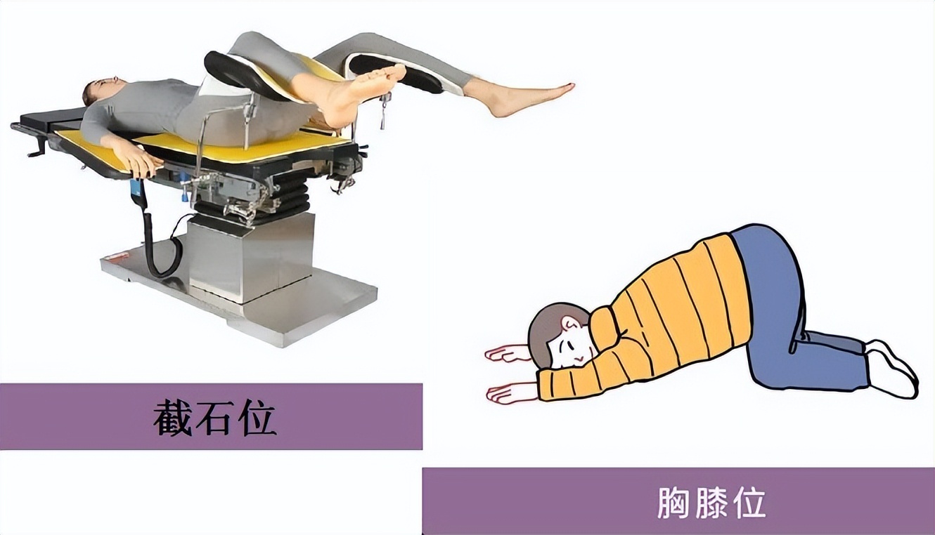 痔疮手术到底有多疼听专家来解答,痔疮手术感觉好尴尬