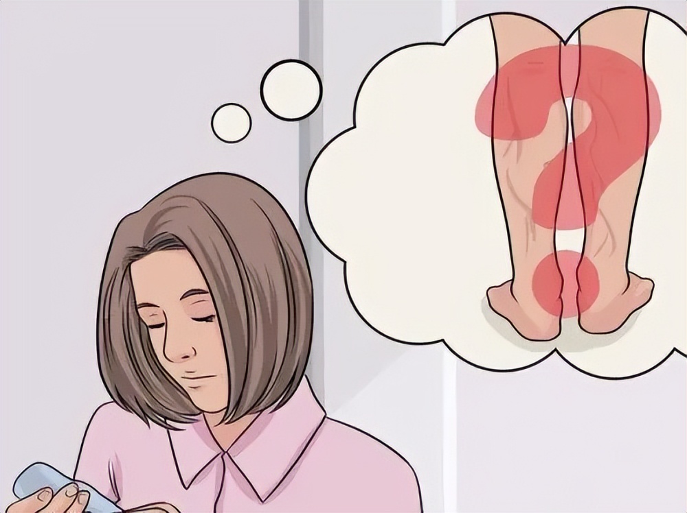 静脉曲张蚯蚓腿怎么回事,静脉曲张多久会形成蚯蚓腿