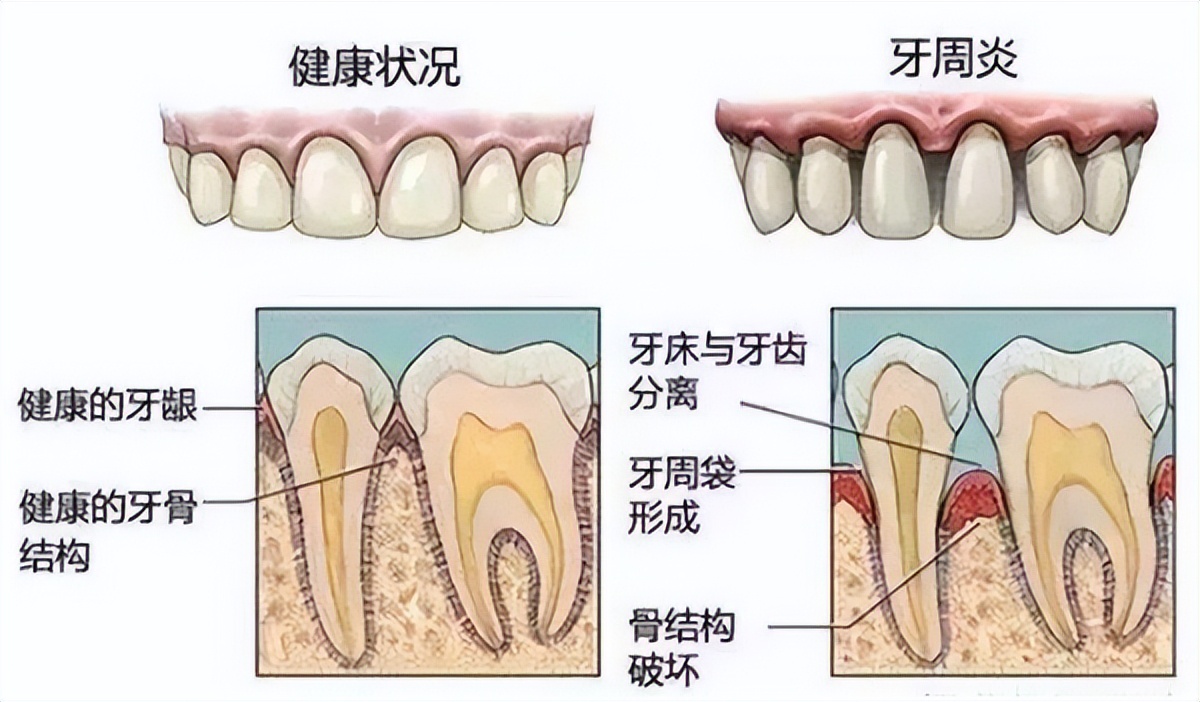 什么牌子的电动牙刷好用测评,哪个品牌的电动牙刷好用测评