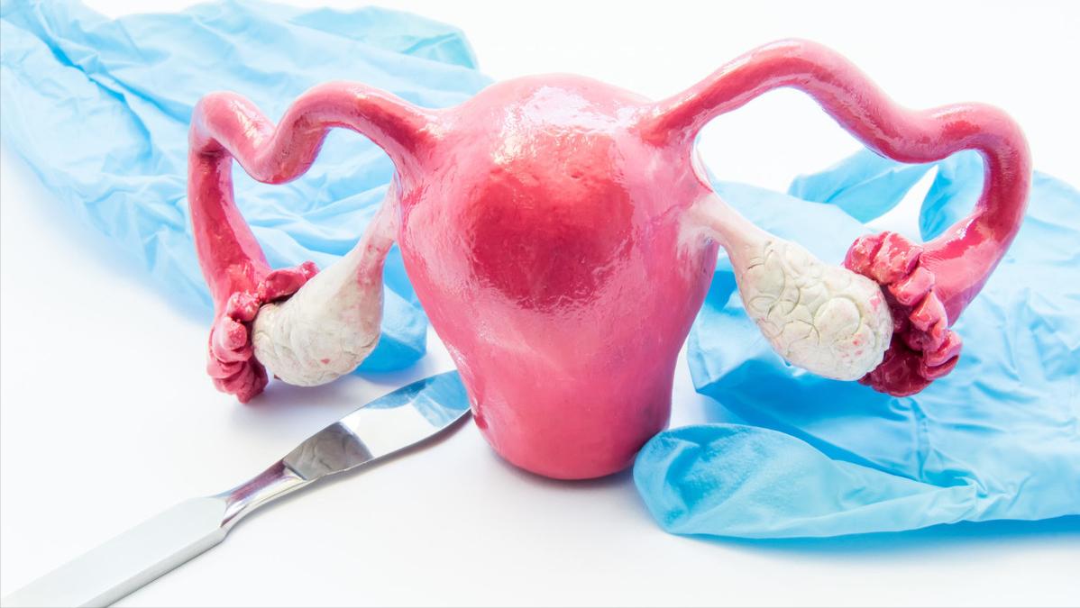 女子头晕胸闷,以为心肺不好,医生看到她的指甲怀疑子宫肌瘤